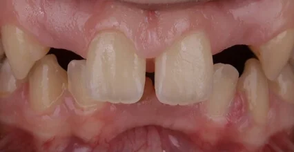 Before Image