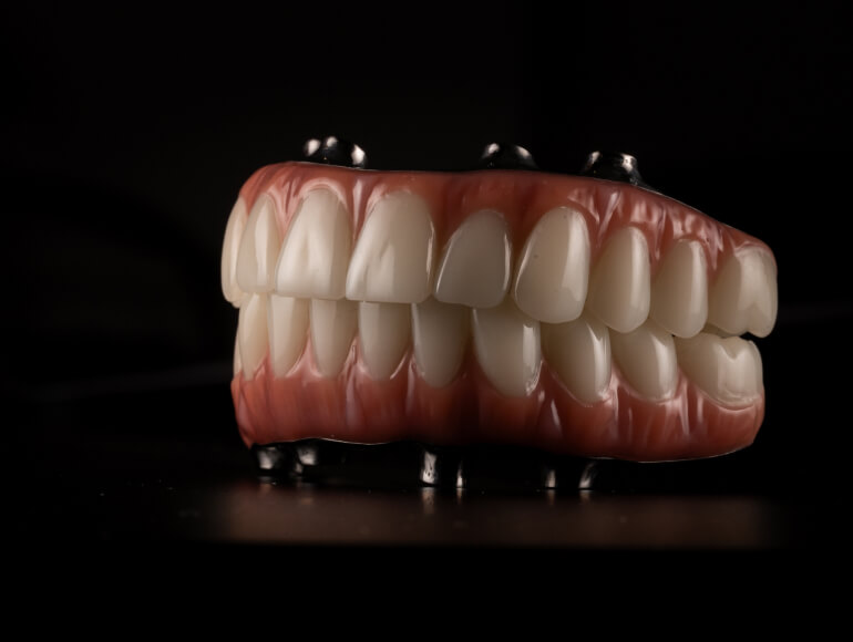 Exploring Your Tooth Replacement Options