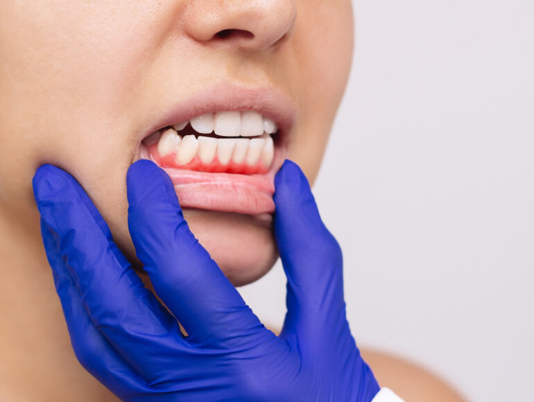 Improve Your Oral Health