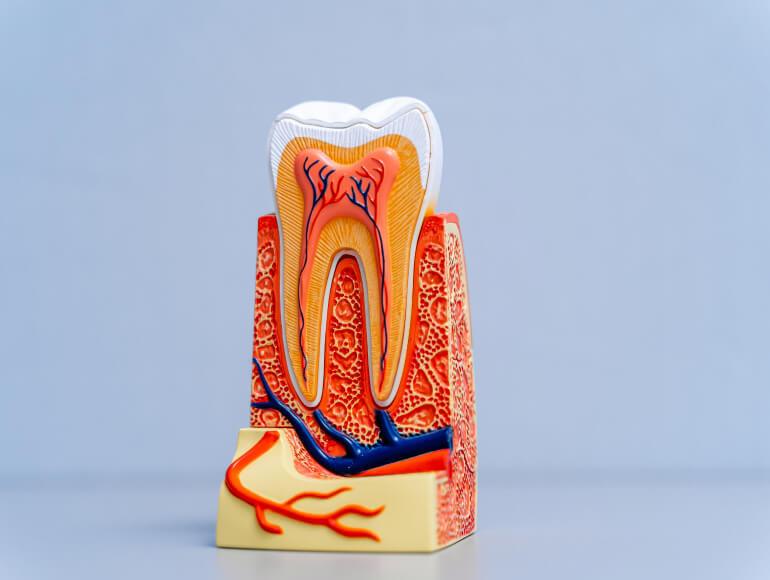 Do You Need Root Canal Therapy?